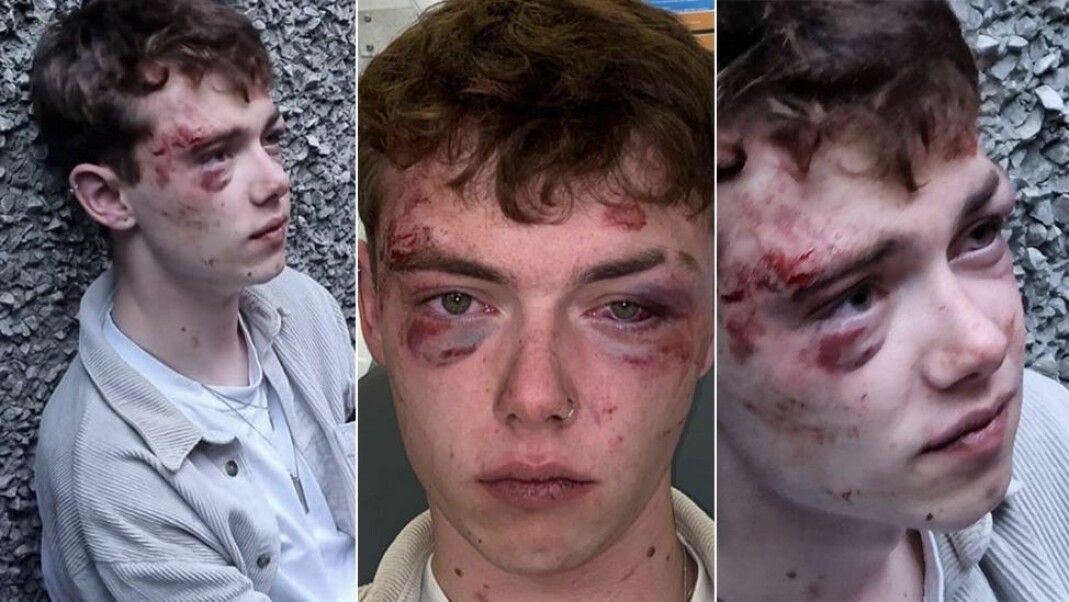 HATKRIMBØLGE I LIVERPOOL: Curtis Stewart (19) ble i oktober i fjor angrepet av en mann og tre kvinner etter å ha fulgt søsteren sin og hennes venninne hjem. "Det skjedde noen minutter etter at jeg slapp dem av. De ropte noe til meg og jeg forsøkte å komme meg unna, men de løp mot meg og begynte å slå" sa Stewart til VICE. HATKRIMBØLGE I LIVERPOOL: Curtis Stewart (19) ble i oktober i fjor angrepet av en mann og tre kvinner etter å ha fulgt søsteren sin og hennes venninne hjem. "Det skjedde noen minutter etter at jeg slapp dem av. De ropte noe til meg og jeg forsøkte å komme meg unna, men de løp mot meg og begynte å slå" sa Stewart til VICE.