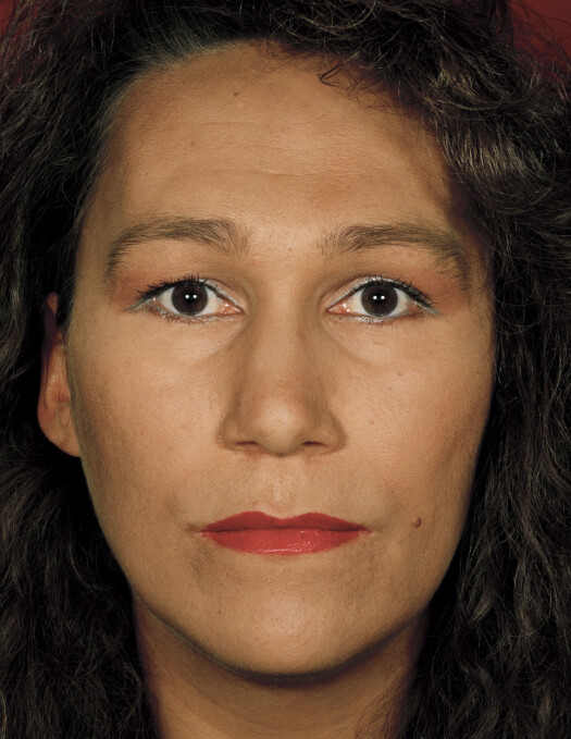 Fra Fin Serck-Hanssens fotoserie «Tema Aids» (1993). Fra Fin Serck-Hanssens fotoserie «Tema Aids» (1993).