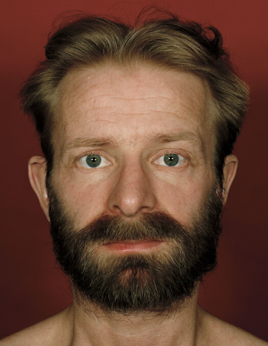 Fra Fin Serck-Hanssens fotoserie «Tema Aids» (1993). Fra Fin Serck-Hanssens fotoserie «Tema Aids» (1993).